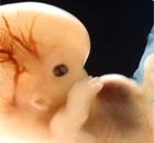 A six-week-old human embryo