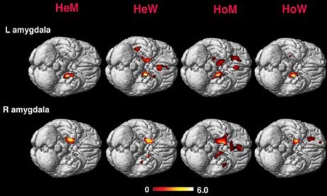 Brain scans showing electrical activity according to sexuality