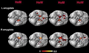 Gay Brains like Straight Women\'s