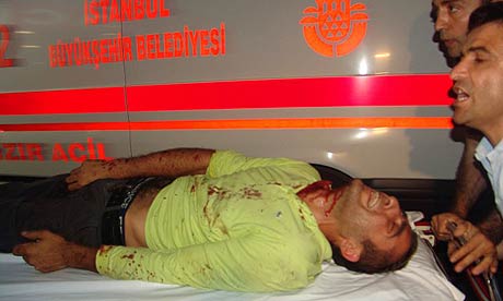 An injured man is taken to hospital following the explosions in Istanbul