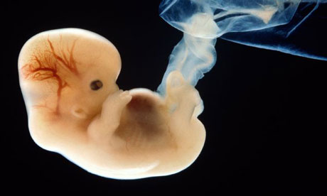Six week old human embryo